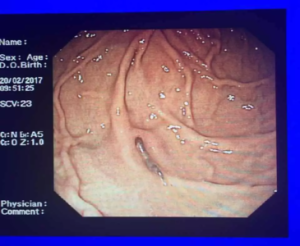 機會致病寄生蟲 機會致病寄生蟲