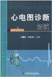 心電圖診斷解讀 心電圖診斷解讀