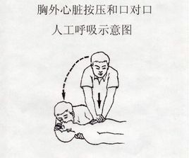 人工呼吸 人工呼吸