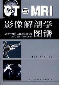 CT與MRI影像解剖學圖譜 CT與MRI影像解剖學圖譜