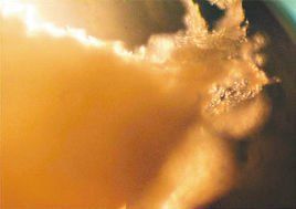 人造肝臟 人造肝臟