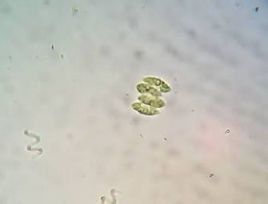 巴西柵藻 巴西柵藻