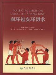 商環包皮環切術 商環包皮環切術