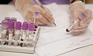 孕前驗血可預防ABO溶血