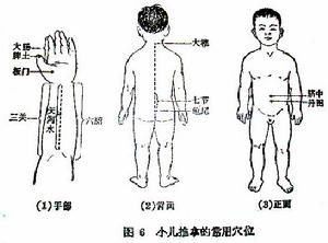小兒捏脊