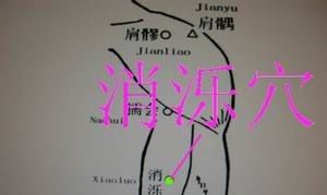 消濼穴