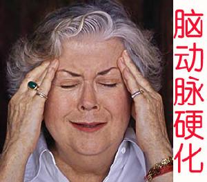 腦動脈硬化伴發的精神障礙