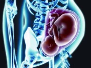 垂直感染 垂直感染