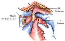 示意圖6:將胃經食管床緩緩向上推送