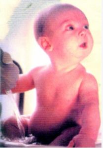 小兒驚厥 小兒驚厥