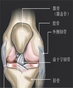 膝關節退行性關節炎
