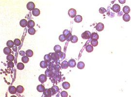 白假絲酵母菌 白假絲酵母菌