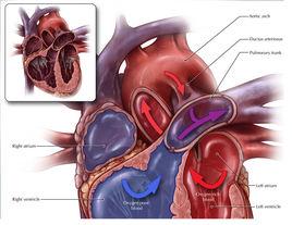 動脈導管