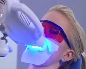 冷光美白 冷光美白