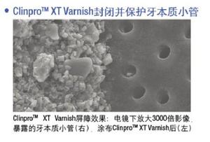 Clinpro XT Varnish屏障效果