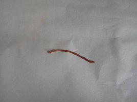 豬肺線蟲病 豬肺線蟲病