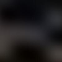 IC 1591 RASS 彩色圖