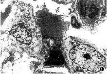 I型肺泡細胞 I型肺泡細胞