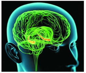 記憶假體 記憶假體