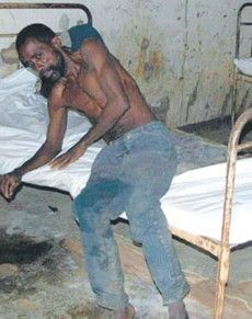 感染伊波拉出血熱的患者