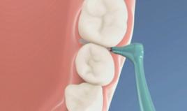 牙間隙刷 牙間隙刷