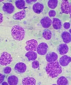 淋巴細胞轉化試驗 淋巴細胞轉化試驗