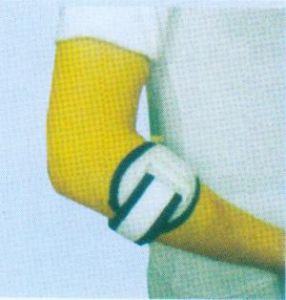 二水焦磷酸鈣結晶沉積症 二水焦磷酸鈣結晶沉積症