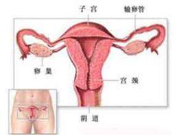 輸卵管腫大 輸卵管腫大