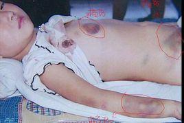 丁香小慧 丁香小慧