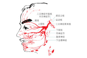 家族性澱粉樣多發性神經病變