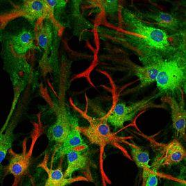 癌幹細胞 癌幹細胞