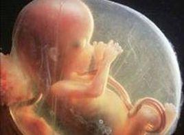 羊水中回聲增強增多 羊水中回聲增強增多