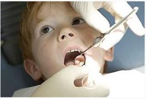 兒童齲齒 兒童齲齒