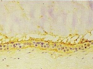 皮下囊腫 皮下囊腫