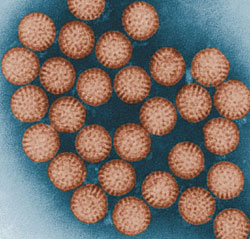 星形病毒胃腸炎 星形病毒胃腸炎