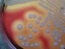 在血瓊脂平板上的典型菌落