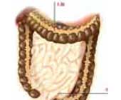 下消化道出血 下消化道出血