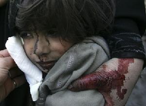 一名在以軍空襲中受傷的巴勒斯坦兒童正在等待治療