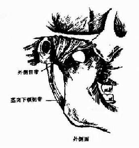 顳下頜關節急性前脫位 顳下頜關節急性前脫位