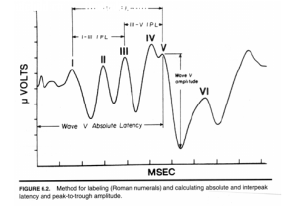 腦幹聽覺誘發電位