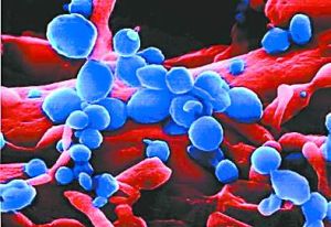 鼻氣管鳥疫桿菌感染---病原