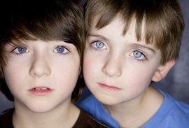 白色人種 白色人種