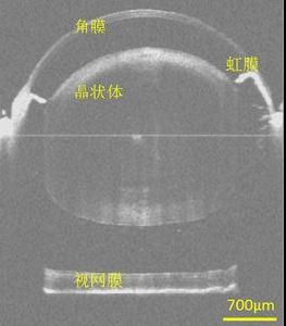光學相干層析成像 光學相干層析成像