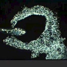 阿米巴變形蟲 阿米巴變形蟲