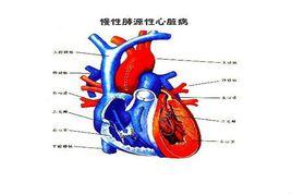 肝頸靜脈回流徵 肝頸靜脈回流徵