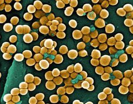 金色葡萄球菌 金色葡萄球菌