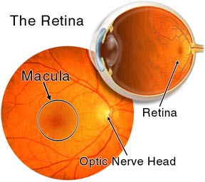 （圖）視網膜