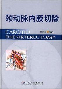 頸動脈內膜切除 頸動脈內膜切除