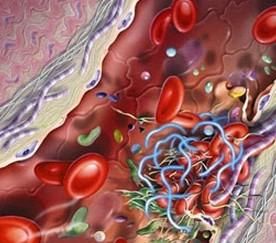 甘油三脂高 甘油三脂高