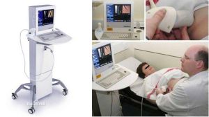 FibroScan FibroScan